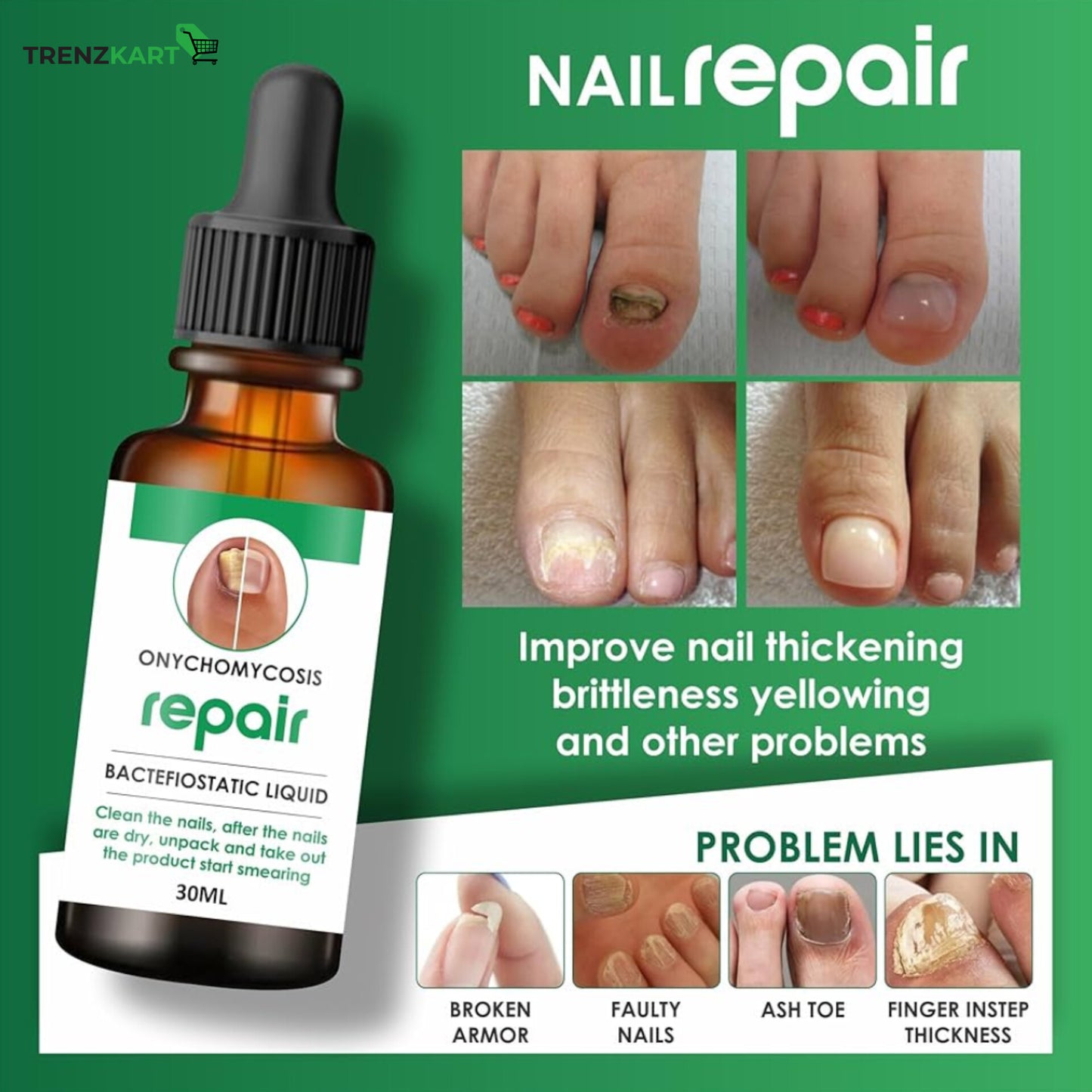 Nail Repair & Growth Serum - Anti-Fungal & Anti-Bacterial (Pack of 2)