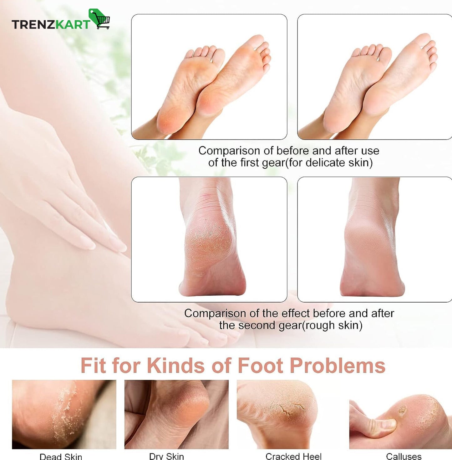 Electric Callus, Dead Skin Remover