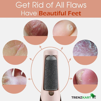 Electric Callus, Dead Skin Remover